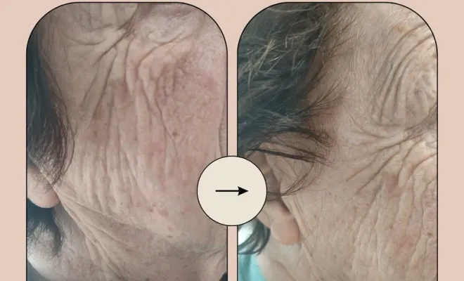 Conseils beauté de la rentrée : les bons gestes pour retrouver une peau éclatante après l’été, Bergerac, Un peu d'Elles